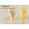 EN-M6 Best Preis Dental Pulp Disease Klinisches Modell vom Hersteller direkt